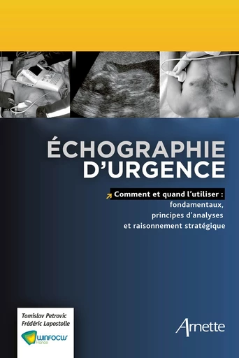 Echographie d'urgence - Tamislav Petrovic, Frédéric Lapostolle - John Libbey