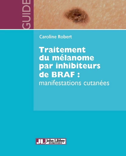 Traitement du mélanome par inhibiteurs de BRAF : manifestations cutanées - Caroline Robert - John Libbey